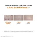 ضد آفتاب فلوئیدی با SPF100 بی رنگ مدل Eyefotona Ak مناسب انواع پوست حجم 50 میل ایزدین